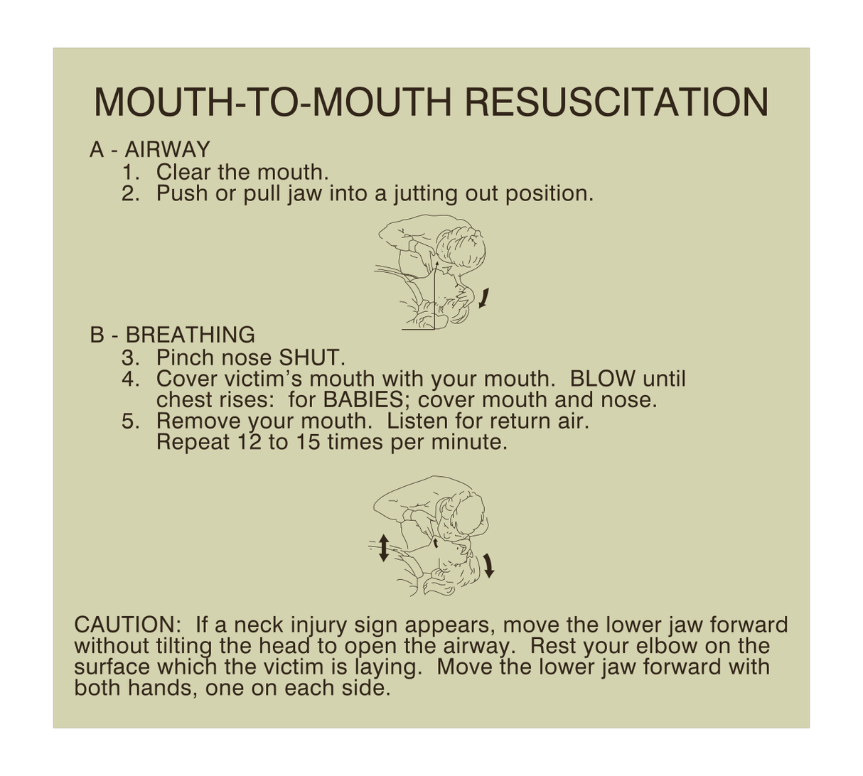 SpringHill Suites Emergency Informational - Resuscitation