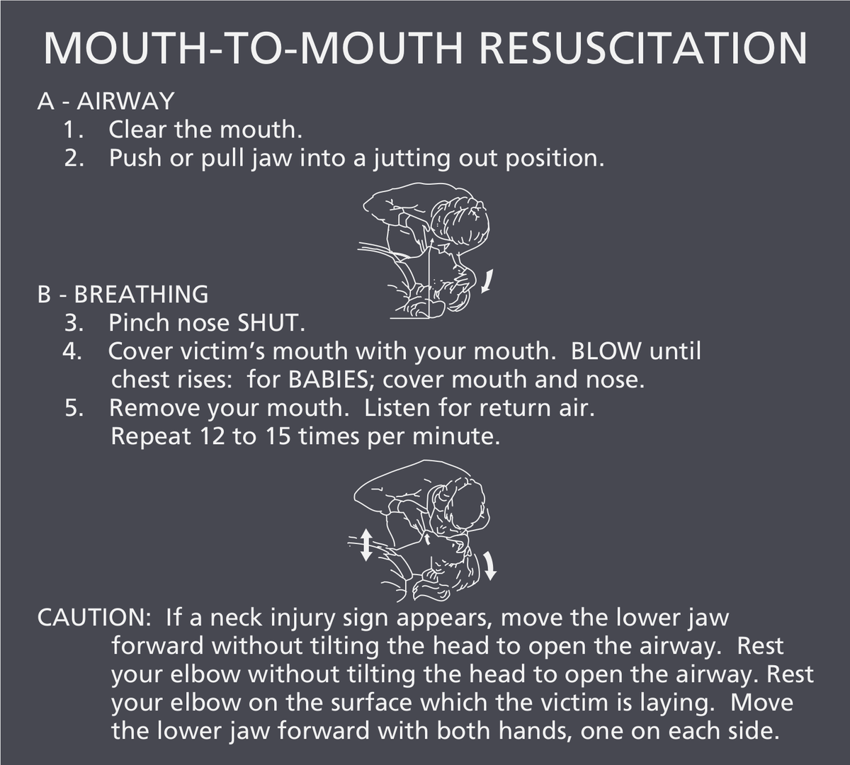 Residence Inn Mouth-to-Mouth Resuscitation